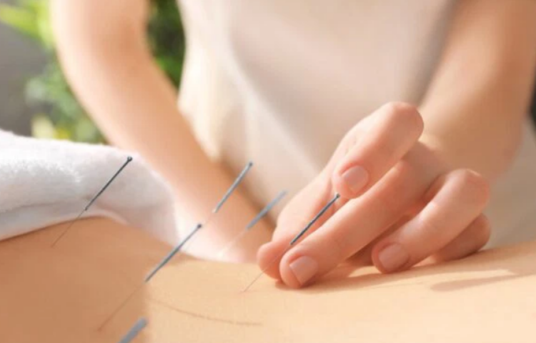 Điện mãng châm điều trị huyết áp thấp